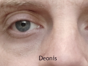 Deonis